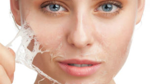 Peeling Médio Facial