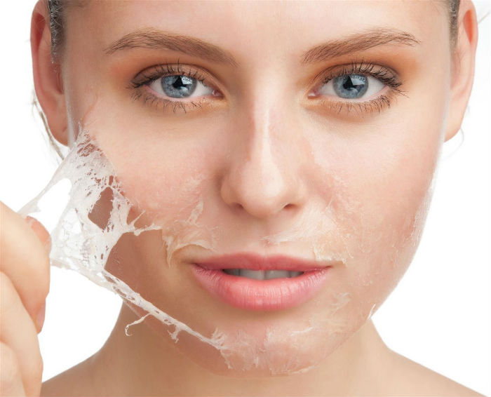 Peeling Medio Facial - Peeling: O Que É, Quais os Tipos e Indicações