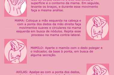 Sintomas, Diagnóstico e Tratamento do Câncer de Mama