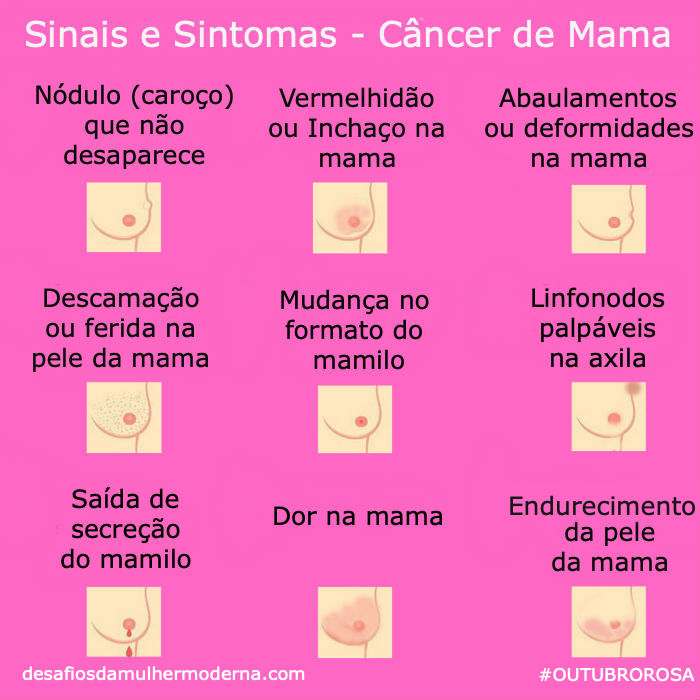 Sinais e Sintomas do Cancer de Mama blog 1 - Sintomas, Diagnóstico e Tratamento do Câncer de Mama